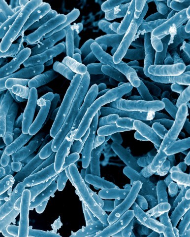Супербактерии Mycobacterium tuberculosis Bacteria